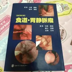 食道・胃静脈瘤