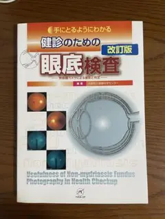 手にとるようにわかる 健診のための眼底検査 改訂版 裁断済み 手にとるようにわかる 健診のための眼底検査 改訂版 裁断済み