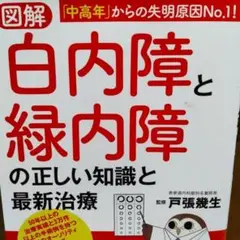 図解白内障と緑内障の正しい知識と最新治療
