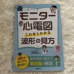 モニター心電図 これならわかる波形の見方