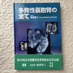 多発性嚢胞腎の全て