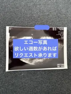 エコー写真欲しい週数あれば承ります