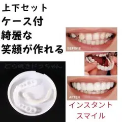 インスタントスマイル コメント不要 上下セット 入歯 人気商品