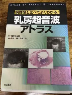 乳房MRIアトラス【裁断済】 乳房MRIアトラス【裁断済】送料 無料 通販