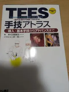2025年最新】TEES(経外耳道的内視鏡下耳科手術)手技アトラスの