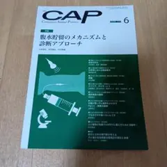 裁断済み　CAP 腹水貯留のメカニズム