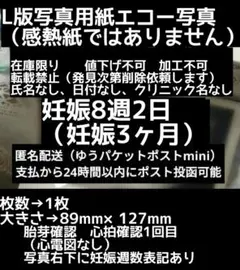 【値下げ不可】L版写真用紙　妊娠8週2日　エコー写真　妊娠初期　妊娠3ヶ月