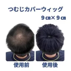 男　メンズ　頭頂部ウィッグ　つむじ　カバー　ポイント　1137　簡単　薄毛　白髪