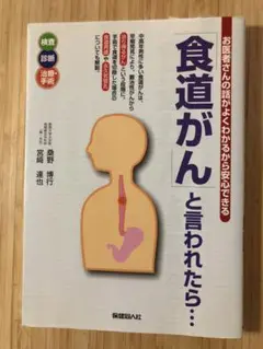 「食道がん」と言われたら… お医者さんの話がよくわかるから安心できる