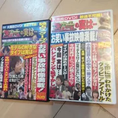 今ちゃんの実は　DVD 2巻セット