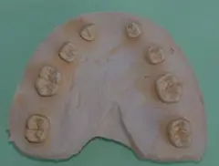 MORPHOLOGY 歯牙形態の類似性　歯科　歯科技工 片岡繁夫先生著「MORPHOLOGY 歯牙形態の類似性」を入手しました
