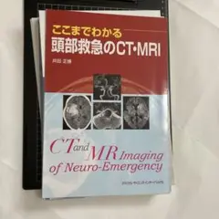 2025年最新】ここまでわかる頭部救急のCT・MRIの人気アイテム