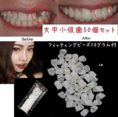 ♠ビッグセール♠被せ型 仮歯50個セット ＆ 10グラム　フィッティングビーズ