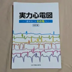 【裁断済】実力心電図 ―「読める」のその先へ― 改訂版