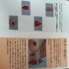 義指、エピテーゼ指、男性用小指 義指、エピテーゼ指、男性用小指オンライン ショッピング 通販