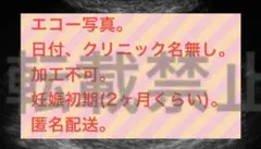 【無断転載】【研究用】エコー写真