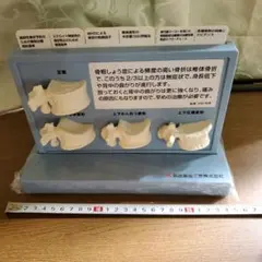 脊椎骨格模型