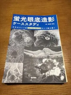 蛍光眼底造影ケ－ススタディ / 飯田知弘 - 紀伊國屋書店ウェブ