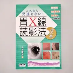 【裁断済】これなら見逃さない!胃X線読影法虎の巻 : シェーマ+内視鏡像+病理像
