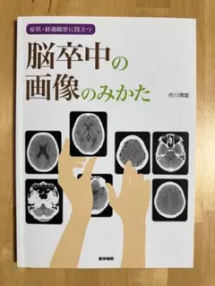 脳卒中の画像のみかた