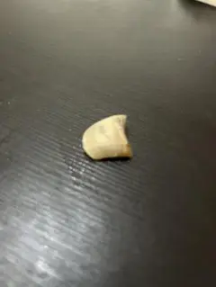 右足親指の爪
