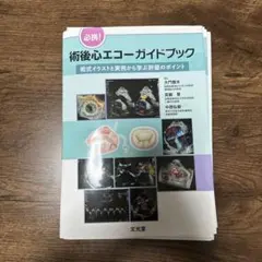 【裁断済】必携!術後心エコーガイドブック 術式イラストと実例から学ぶ 必携！術後心エコーガイドブック 術式イラストと実例から学ぶ