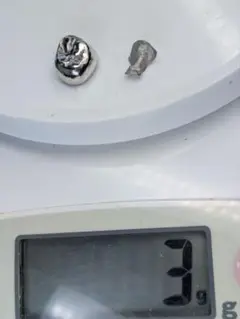 銀歯