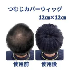 頭頂部ウィッグ　つむじ　カバー　男　メンズ　ポイント　1136　簡単　薄毛　白髪