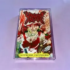VISCERA INFEST ゴアグラインド奇形児柄 TERATOMA / テラトーマ/VISCERA INFEST/ヴィセラ・インフェスト