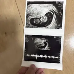 エコー写真　本物です