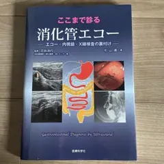 裁断済　ここまで診る消化管エコー エコー・内視鏡・X線検査の裏付け ここまで診る消化管エコー ―エコー・内視鏡・X線検査の裏付け