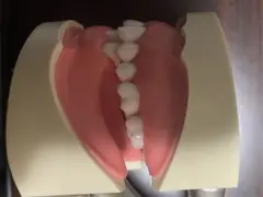 歯科模型　部分床用