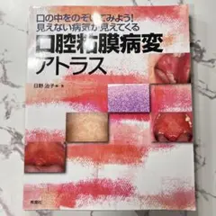 【裁断済み】口腔粘膜病変アトラス