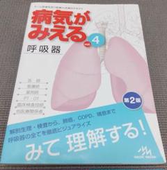 病気が見える Vol.4 呼吸器 第2版