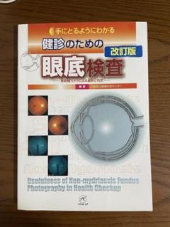 手にとるようにわかる健診のための眼底検査 無散瞳カメラによる撮影と判定 改訂版 手にとるようにわかる健診のための眼底検査 : 無散瞳カメラ
