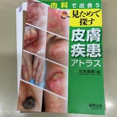 2025年最新】皮膚 アトラスの人気アイテム - メルカリ