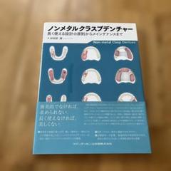 ノンメタルクラスプデンチャー