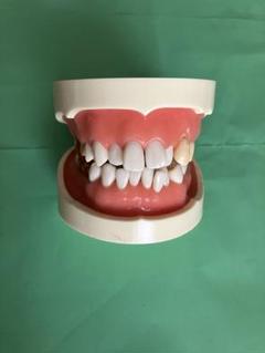NISSIN DENTAL MODEL 可動式上下顎模型 NISSIN ニッシン DENTAL MODEL 顎模型《大小セット》歯の模型