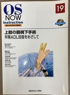 上肢の鏡視下手術 早期ADL回復をめざして
