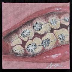 ◇一点物◇　歯 矯正 絵のサムネイル