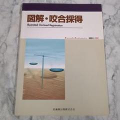 図解・咬合採得