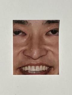 ジャルジャルグッズ５点セット ジャルジャル グッズセット 新品未開封の通販 by ppp｜ラクマ