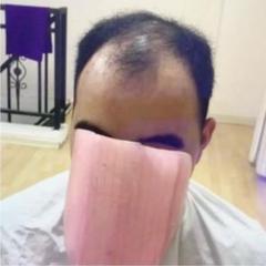 人毛100%総引き抜き全面手植え スーパーワイドL男性用ヘアピース