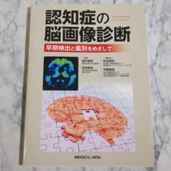 【美品】認知症の脳画像診断