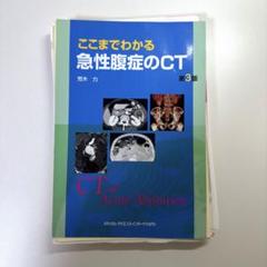 2025年最新】急性腹症のctの人気アイテム - メルカリ
