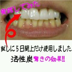 活性炭ホワイトニング