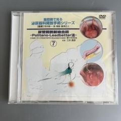 DVD＞実況!!泌尿器腹腔鏡手術シリ-ズ 2 () 腹腔鏡で見る 尿管膀胱新吻合術-Politano-Leadbette法- 7 - メルカリ