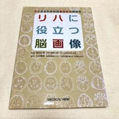 リハに役立つ脳画像