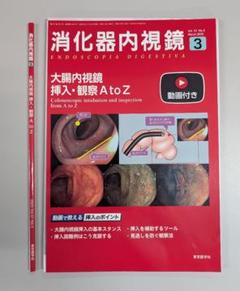 消化器内視鏡 2025年3月号