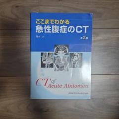 ここまでわかる急性腹症のCT ここまでわかる急性腹症のCT 第2版 | 荒木 力 |本 | 通販 | Amazon